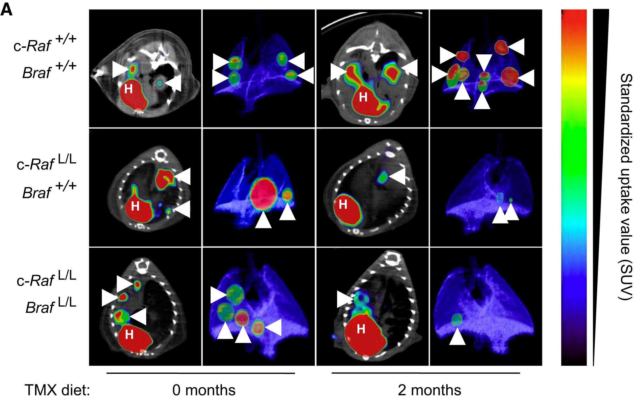 CT reconstructions showing lung tumor regression